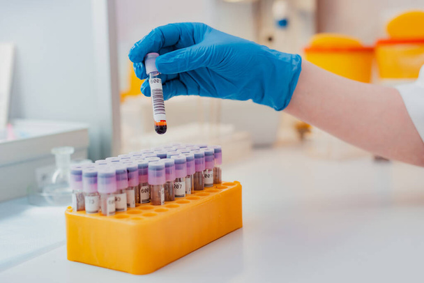 ピペットと血液サンプルチューブと他のサンプルとのスタンドを持つ研究室のアシスタントは、検査のための血液検査管を保持しています。ウイルスの血液検査、コロナウイルス - 写真・画像