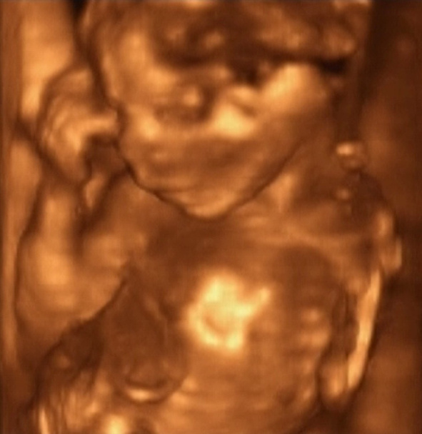tří dimenzionální ultrazvuk - Fotografie, Obrázek