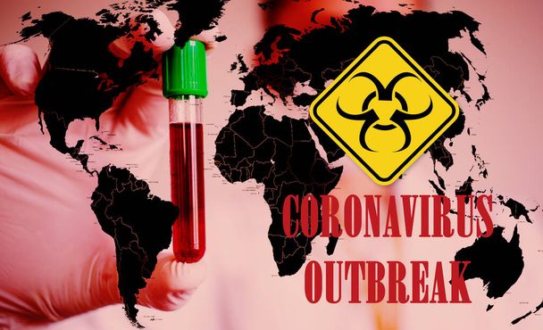 Коронавірус глобальна боротьба Італія карантин - Ковід-19 - заборона на подорожі, карантин - Фото, зображення