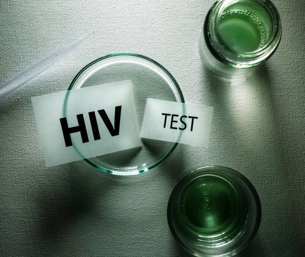 HIV test tags in laboratory background - Фото, зображення