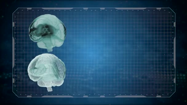 Ηλεκτρονική ιατρική τομογραφία Mri σάρωση του ανθρώπινου εγκεφάλου πάνω από gridded σκοτεινό φόντο. - Πλάνα, βίντεο