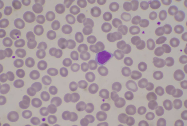 Λευκοκυττάρων του αίματος λεμφοκυττάρων σε ερυθρά αιμοσφαίρια υπόβαθρο αιματολογίας έννοια. - Φωτογραφία, εικόνα
