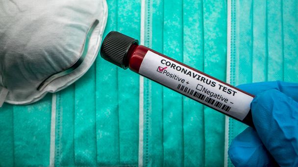 Surgical mask with coronavirus Covid 19 infected blood sample in tube. Vaccine research of virus 2019-nCoV at laboratory. Disease 2019 from Wuhan. Pandemic infectious concept - Fotografie, Obrázek