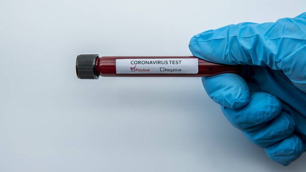 Pozitív COVID-19 teszt és laboratóriumi vérvizsgálat új Corona vírusfertőzés diagnosztizálására. 2019-es betegség Wuhan-tól. Pandémiás fertőző fogalom - Fotó, kép