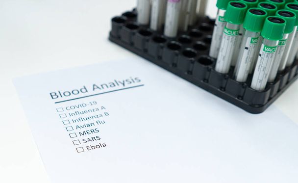 Bloedbuis voor het testen van de besmettelijke ziekte, waaronder covid-19, influenza en b, vogelgriep, Mers, Sars, en ebola op de witte achtergrond - Foto, afbeelding