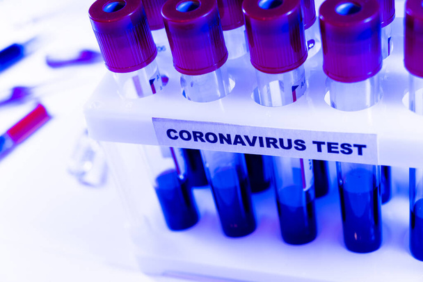 Coronavirus blood test concept. Analyzing blood sample in test tube for coronavirus test. Test tube with blood for 2019-nCoV analyzing. Coronavirus blood analysis concept.  - Fotografie, Obrázek