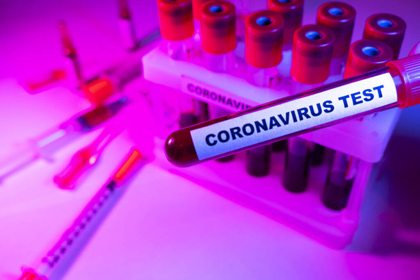 Coronavirus blood test concept. Analyzing blood sample in test tube for coronavirus test. Test tube with blood for 2019-nCoV analyzing. Coronavirus blood analysis concept. - 写真・画像