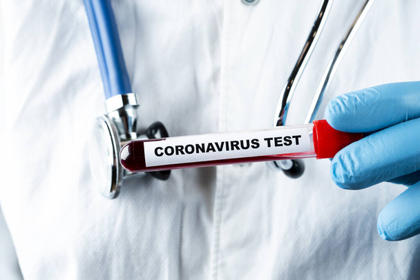Coronavirus blood test concept. Analyzing blood sample in test tube for coronavirus test in doctor hand. Test tube with blood for 2019-nCoV analyzing. Coronavirus blood analysis concept. - Foto, Imagem
