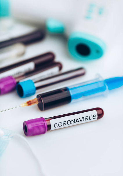 Testar a amostra de laboratório do novo Coronavirus
  - Foto, Imagem