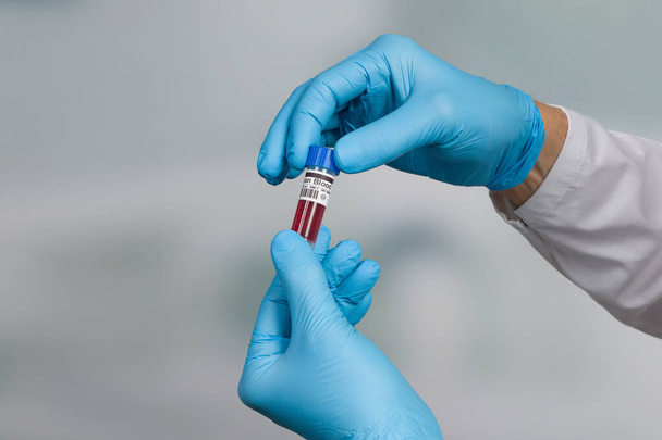 primer plano de la mano en guantes médicos que sostienen un tubo de análisis de sangre frente a una sala de laboratorio
 - Foto, Imagen
