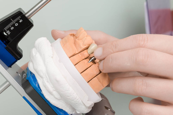 fogászati laboratóriumban artikulátoron elhelyezett implantátummal kapcsolatos munka lezárása - Fotó, kép