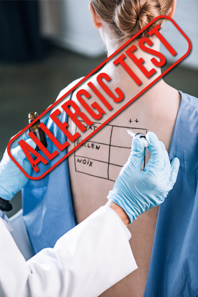 bijgesneden mening van allergist houden pipet in de buurt van vrouw met letters op gemarkeerde rug met allergische test illustratie - Foto, afbeelding