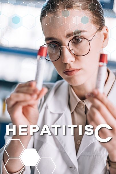 enfoque selectivo de hermosa inmunólogo en gafas mirando tubos de ensayo, Hepatitis c ilustración
 - Foto, Imagen