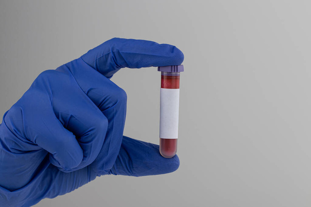 Enfermeira segurando tubo de teste com sangue, close-up. Conceito de análise ao sangue
 - Foto, Imagem