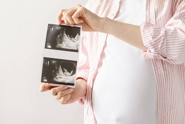 Pregnant woman with ultrasound result in hands on bright background . Motherhood, medicine and love item - Foto, Imagem