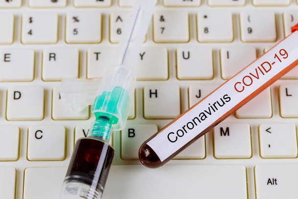 Lékař provádějící krevní testy COVID-19 koronavirus atypická pneumonie, virus - Fotografie, Obrázek