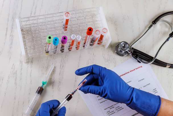 Тестові трубки, наповнені кров'ю у контрольній лабораторії коронавірусу COVID-19
 - Фото, зображення