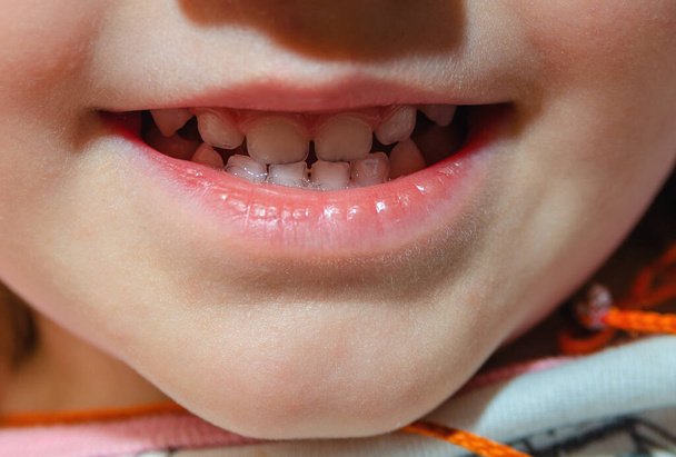 Посмішка з зубами маленької дитини, дошкільнята
 - Фото, зображення