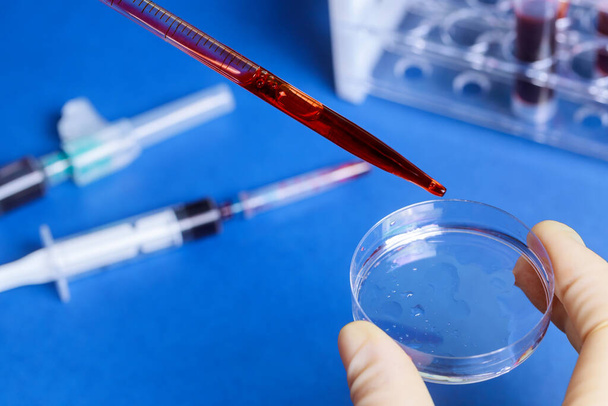 Amostra de sangue com pipeta e placa de Petri outros tubos de teste de sangue em um hospital de análise de teste de teste rack
 - Foto, Imagem