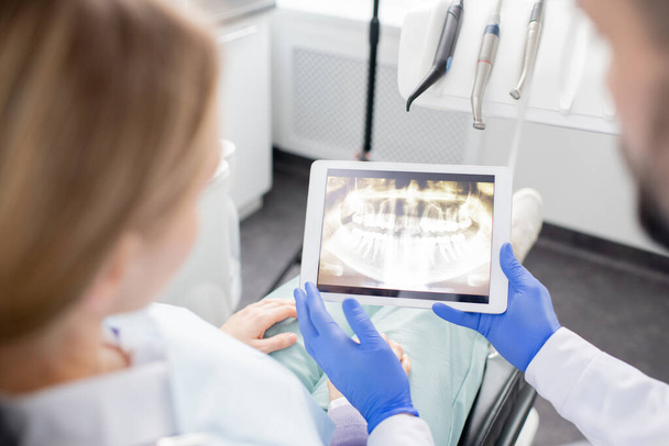 Mains gantées de dentiste professionnel avec comprimé montrant le patient féminin radiographie des dents avant traitement médical
 - Photo, image