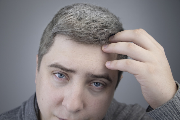 Un trichologue examine un jeune homme cheveux gris sous une loupe. Blanchiment plus tôt des cheveux et des pigments comme un signe de mélanine faible dans un corps
 - Photo, image