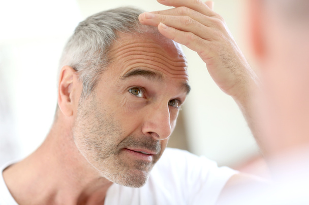 Homme âgé et problème de perte de cheveux
 - Photo, image