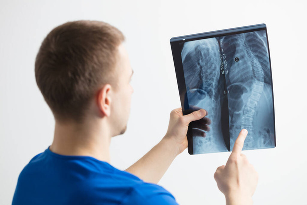 The doctor examines the x-ray image of the spine.The doctor is holding a photo of fluorography on a white background - Zdjęcie, obraz