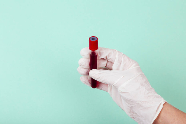 Muestra de sangre de la mano en el tubo de ensayo. Concepto de Coronavirus
 - Foto, imagen
