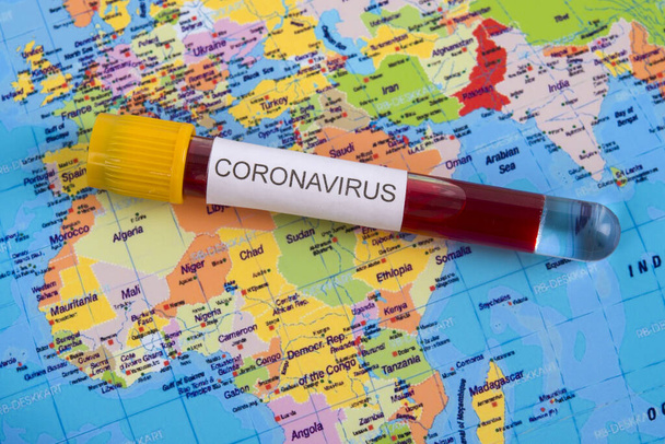 Dünya haritasındaki test tüplerindeki Coronavirus kan örneği. Salgın Koronavirüs Araştırma ve Tedavi Konsepti. - Fotoğraf, Görsel