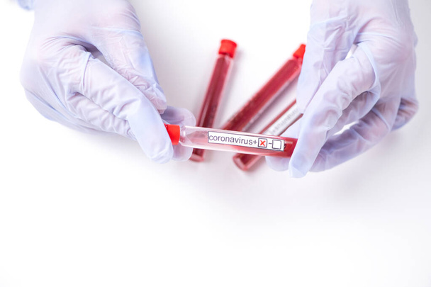coronavirus test tube with blood on hand - Zdjęcie, obraz