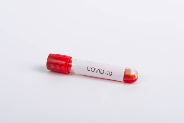 Коронавирус 2019-nCoV Blood Sample в пробирках. Вспышка вируса Короны. Эпидемический вирус респираторного синдрома, Китай. Концепция исследования и лечения
. - Фото, изображение