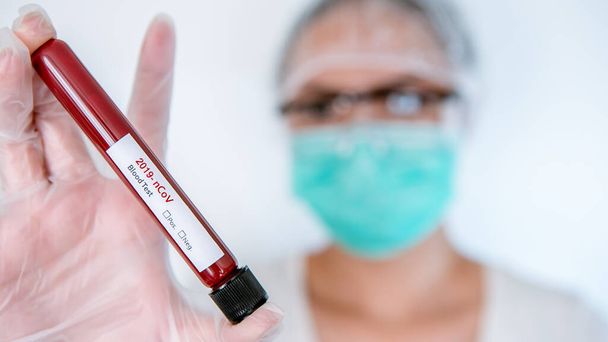 Asian woman scientist with coronavirus Covid 19 infected blood sample in tube. Vaccine research of virus 2019-nCoV at laboratory. Disease 2019 from Wuhan. Pandemic infectious concept - 写真・画像