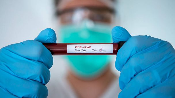 Mies, jolla on negatiivinen koeputki tartunnan saanutta verinäytettä COVID-19: lle, uusi koronavirus, joka löytyi Wuhanista, Kiinasta. Tiedemies, jolla on siniset käsineet ja naamio suojaksi. Rokotetutkimus virukselle 2019-nCoV
 - Valokuva, kuva