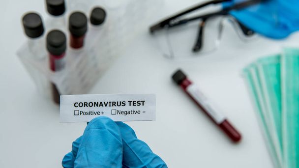 青い手袋の科学者は、コロナウイルス検査用血液サンプルチューブの識別子ステッカー、 COVID-19を保持しています。ウイルスは緊急事態を引き起こした。2019-nCVのワクチン研究. - 写真・画像