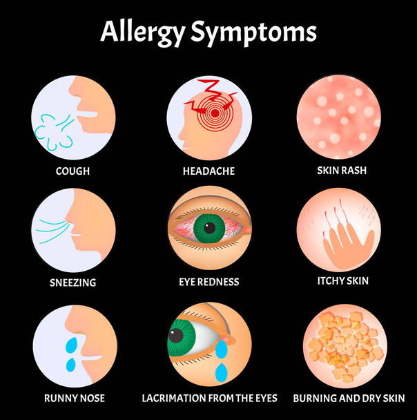 Συμπτώματα Αλλεργιών Δερματικό εξάνθημα, Αλλεργική κνησμός δέρματος, Σκίσιμο από τα μάτια, Βήχας, Φτερνίζει, Τρέχει μύτη, Πονοκέφαλος, Ερυθρότητα των ματιών. αλλεργία Infographics. Εικονογράφηση διανύσματος. - Διάνυσμα, εικόνα