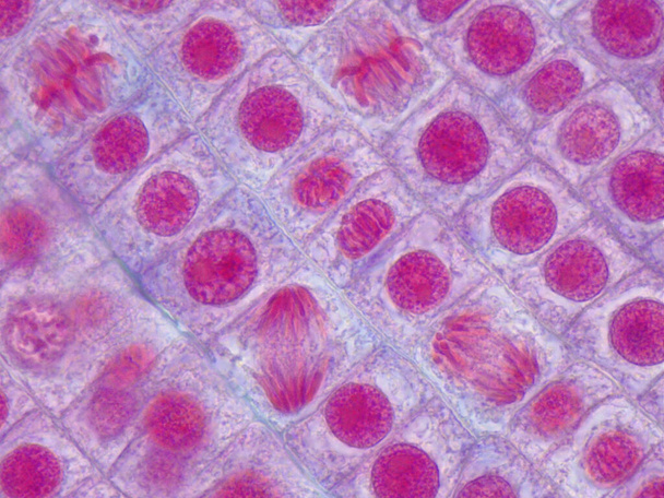 Μικροσκοπική εικόνα των ριζικών κυττάρων κρεμμυδιού που υποβάλλονται σε μίτωση. Αναφάσεις και μεταφάσεις. Μεγέθυνση 1000x - Φωτογραφία, εικόνα