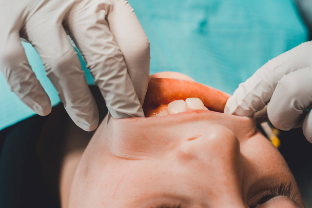 Diş muayenehanesindeki çocuk, yeni dişleri inceliyor ve kusurlu olanları tedavi ediyor. 2020 - Fotoğraf, Görsel