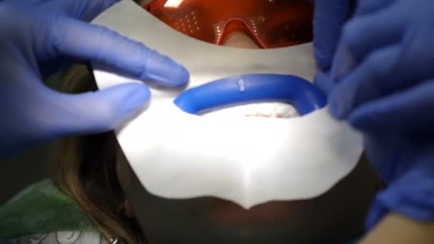 Moderne tandheelkundige kliniek concept. Bovenaanzicht. Voorbereiding voor professionele cosmetische tanden bleken in tandarts kliniek. Vrouwelijke patiënt in tandartspraktijk op stoel. Teeth whitening procedure... close-up. 4 km - Video