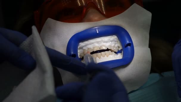 Hammashoitolan konsepti. Top näkymä hammaslääkäri tutkii nuori nälänhätä potilas. tiiviissä yhteistyössä lääkärin ja avustajan kanssa. Stomatologi pitelee hammastyökaluja. Nykyaikaisessa hammashoitolassa. 4 k video
 - Materiaali, video