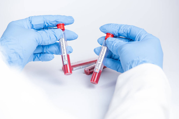 El ele tutuşan Coronavirus test tüpü ve beyaz üzerinde kan  - Fotoğraf, Görsel