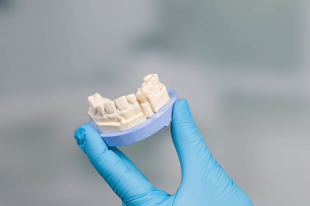 primo piano della mano del dentista in guanti medici che presentano un'impronta dentale con una nuova dentizione artificiale pronta per l'uso
 - Foto, immagini