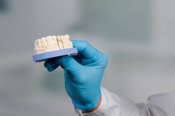 οδοντίατρος χέρι σε γάντια παρουσιάζουν ένα οδοντιατρικό αποτύπωμα με τεχνητή οδοντοστοιχία έτοιμη για χρήση - Φωτογραφία, εικόνα