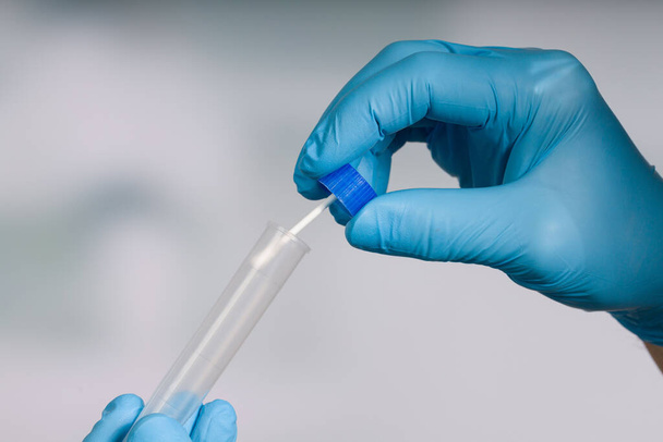 Close up of handling a smear test in a medical laboratory  - Zdjęcie, obraz