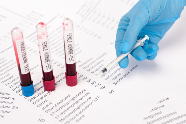 Vista recortada del médico sosteniendo la jeringa cerca de los tubos de ensayo con muestras de sangre y listas con hormonas
  - Foto, Imagen