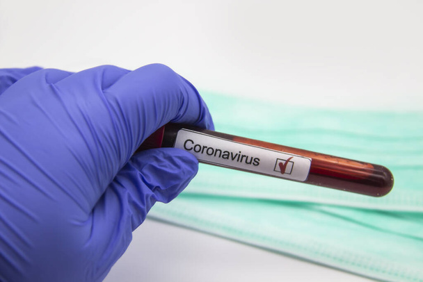 Coronavirus test sanguin 2019.Coronavirus est venu de Wuhan, en Chine. Main du médecin dans un gant médical tenant une éprouvette avec du sang positif au coronavirus en laboratoire. Concept peut être utilisé dans la conception
 - Photo, image