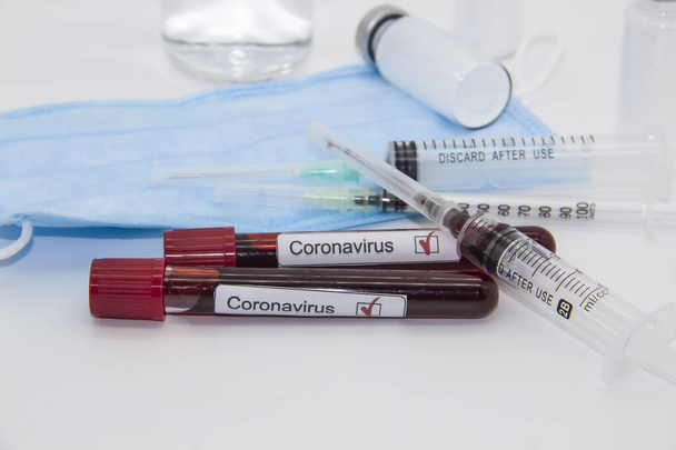 Коронавірус - аналіз крові. Тестові трубки з коронавірусною позитивною кров'ю над лабораторним столом. Концепція Ковида-19 може бути використана в дизайні - Фото, зображення