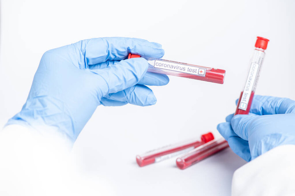 Coronavirus acil durum eli beyaz üzerinde kan olan koronavirüs test tüpünü tutuyor. - Fotoğraf, Görsel