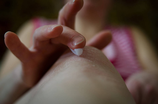 Нанесення мазі при лікуванні та зволоженні шкіри псоріазом. Жінка наносить пом'якшувальний на болісне коліно
  - Фото, зображення