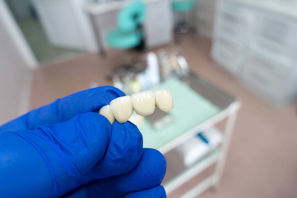 strutture dentarie artificiali nelle mani di un dentista - Foto, immagini