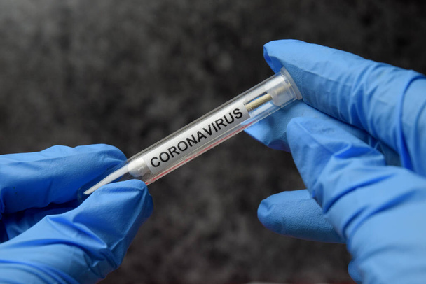 Coronavirus-Test weltweit neue Pandemie - Foto, Bild